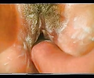 Anal fisting